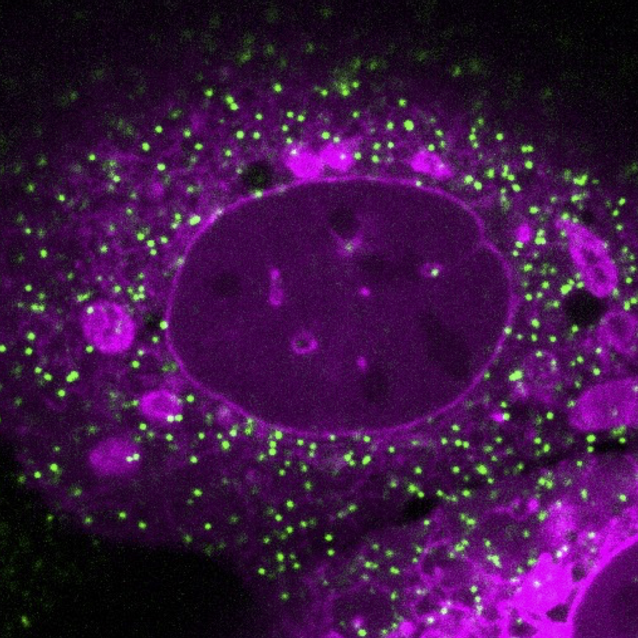 A fluorescently labeled cell with bright green dots, called gems, in the cytoplasm