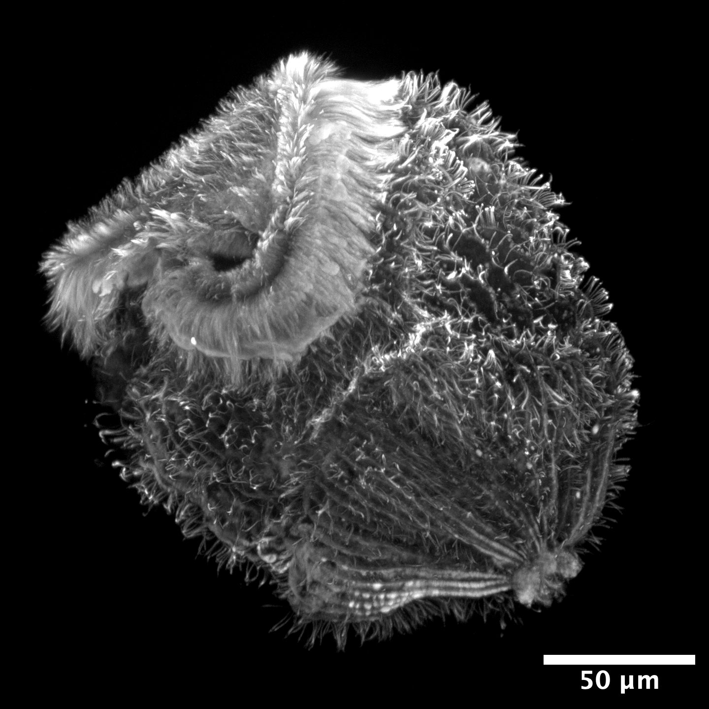 a stentor cell with tubulin labeled so it appears as a fuzzy sphere with a mouth at one end and a tail at the other